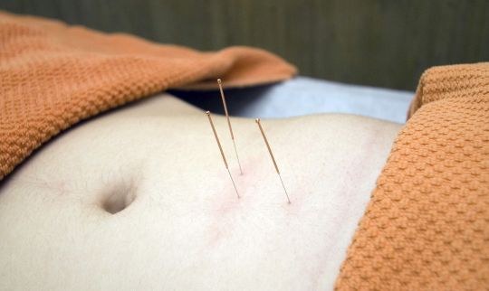 Hvad er akupunktur?